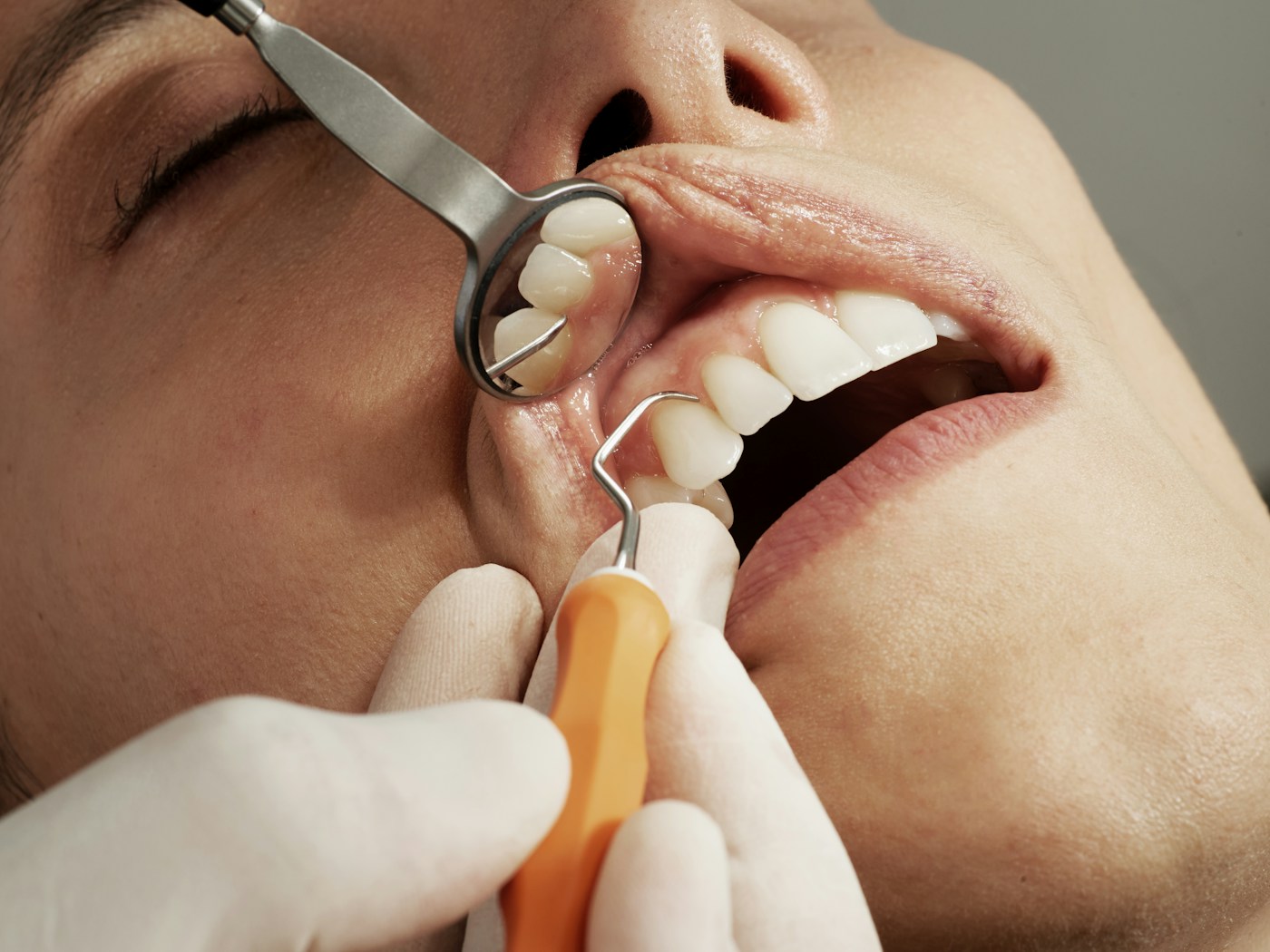 Fotografía editorial de una revisión dental; no es una imagen de la clínica